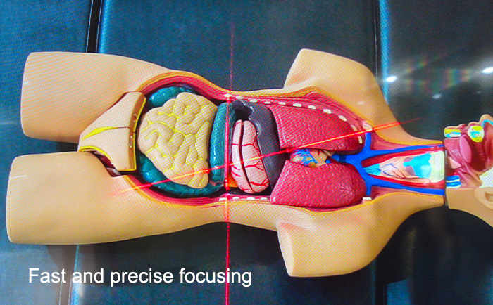 surgical video cameras Fast and accurate focus