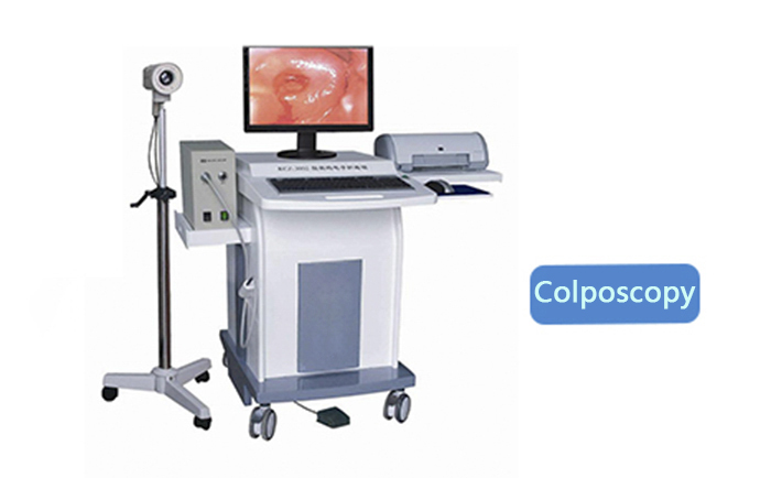 electronic colposcopy